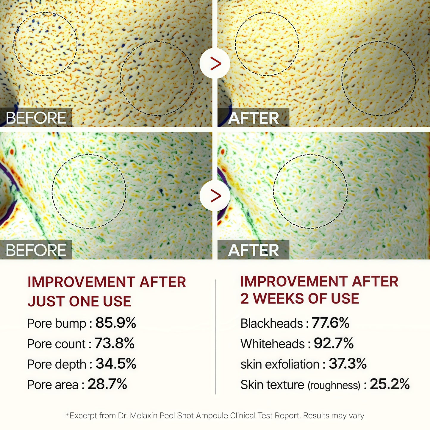 Dr.Melaxin Peel Shot Glow Rice Line