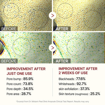 Dr.Melaxin Peel Shot Glow Rice Line