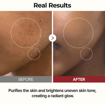 Dr.Melaxin Peel Shot Glow Rice Line